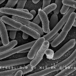 Benefits of Bacteria_EscherichiaColi NIAID by Rocky Mountain Laboratories
